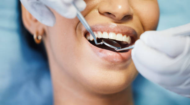 Best Emergency Treatment for Oral Infections in Alexandria Bay, NY