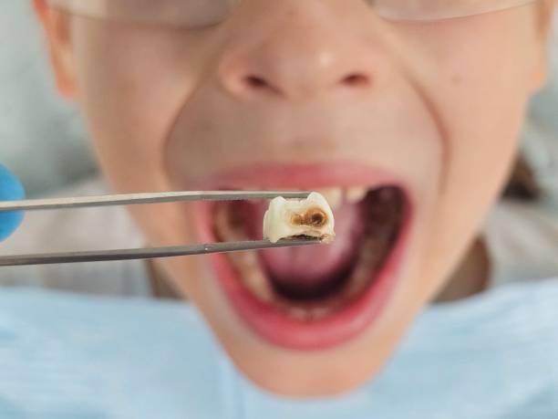 Best Emergency Pediatric Dental Care in Alexandria Bay, NY